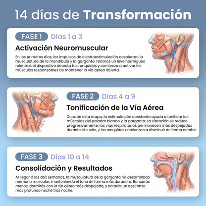 Dispositivo Inteligente Anti-Ronquidos